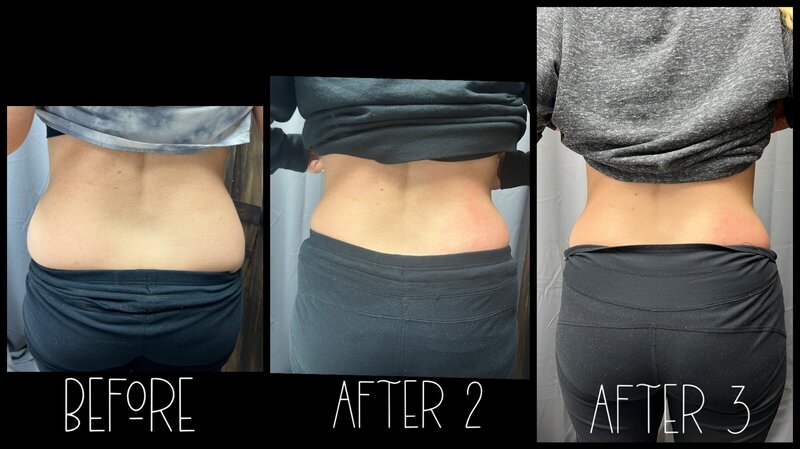 UltrasonicCavitationB&A