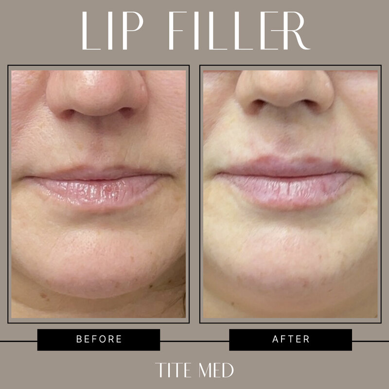 TITE-BEFOREAFTER copy