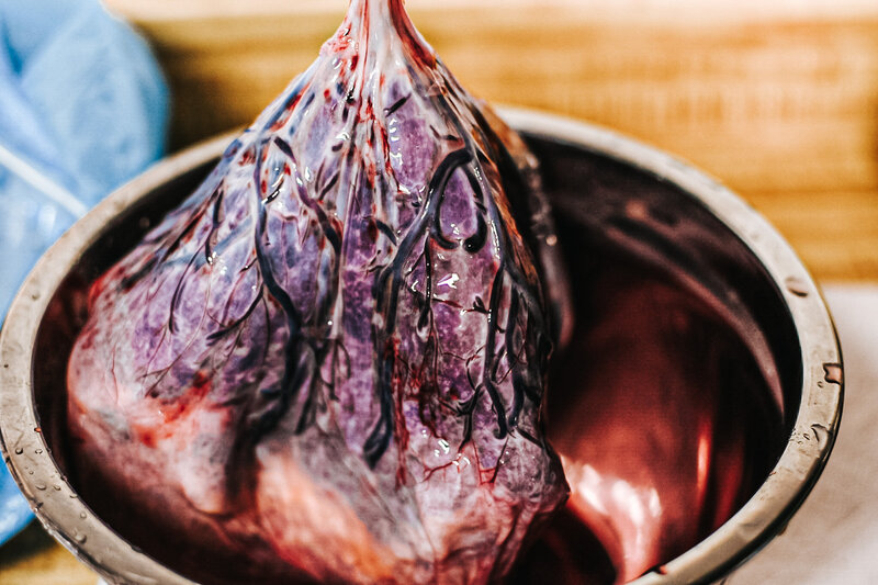 PITTSBURGH  Placenta encapsulation