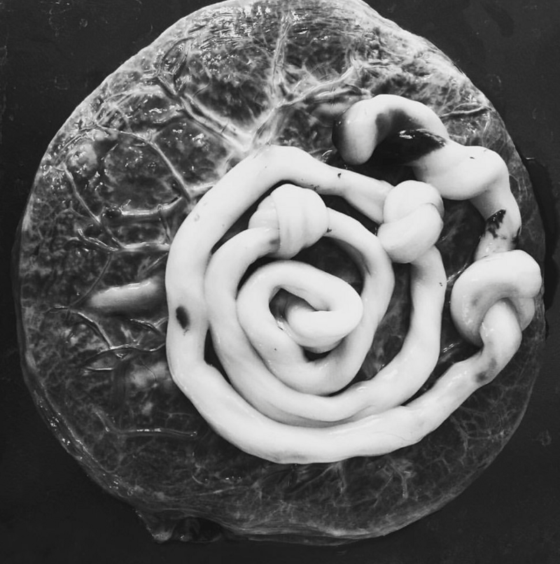 Black and white photo  of a placenta
