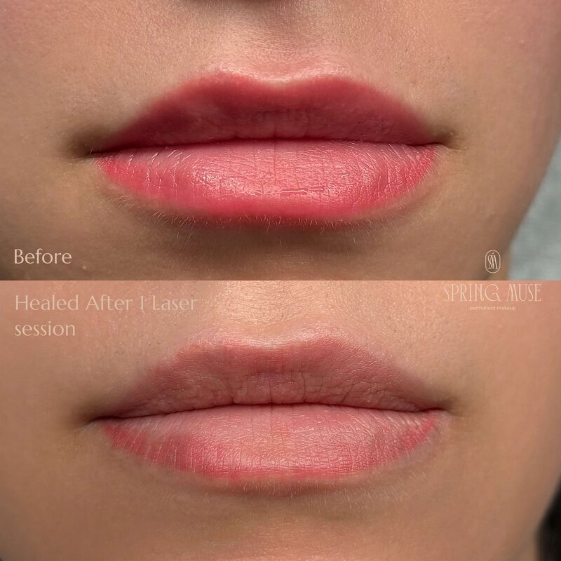 Lip Blush Removal
