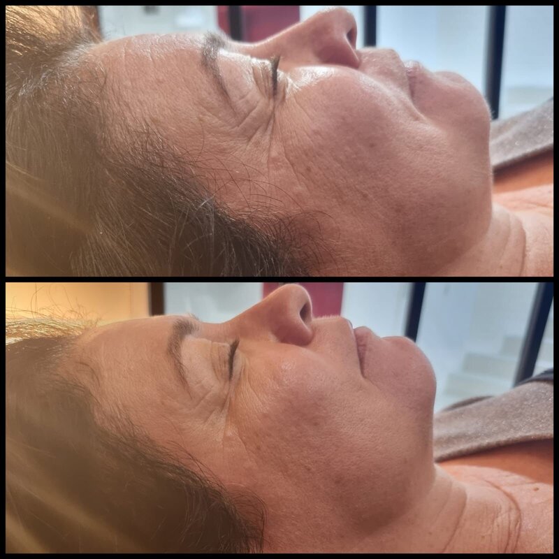 avant après du jetpeel
