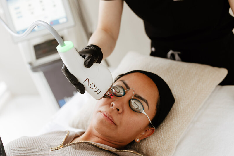A client receiving a MOXI laser treatment, known for its non-invasive approach to achieving smoother, more even skin.