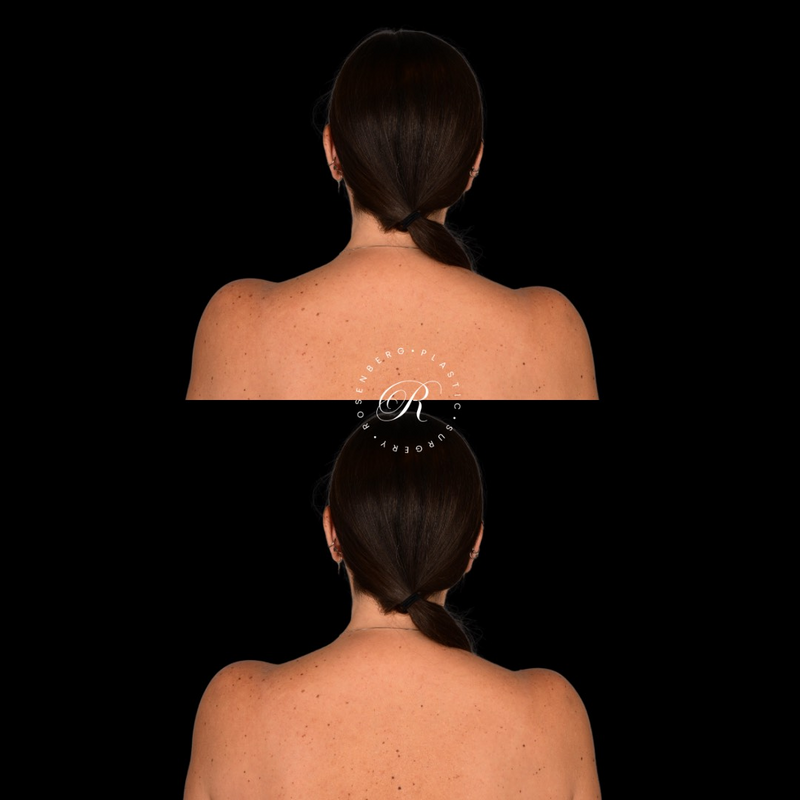 Copy of Template for Rosenberg Plastic Surgery B - 16