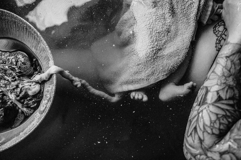 placenta floating in a bowl with umbilical cord, baby toes and vernix in the water