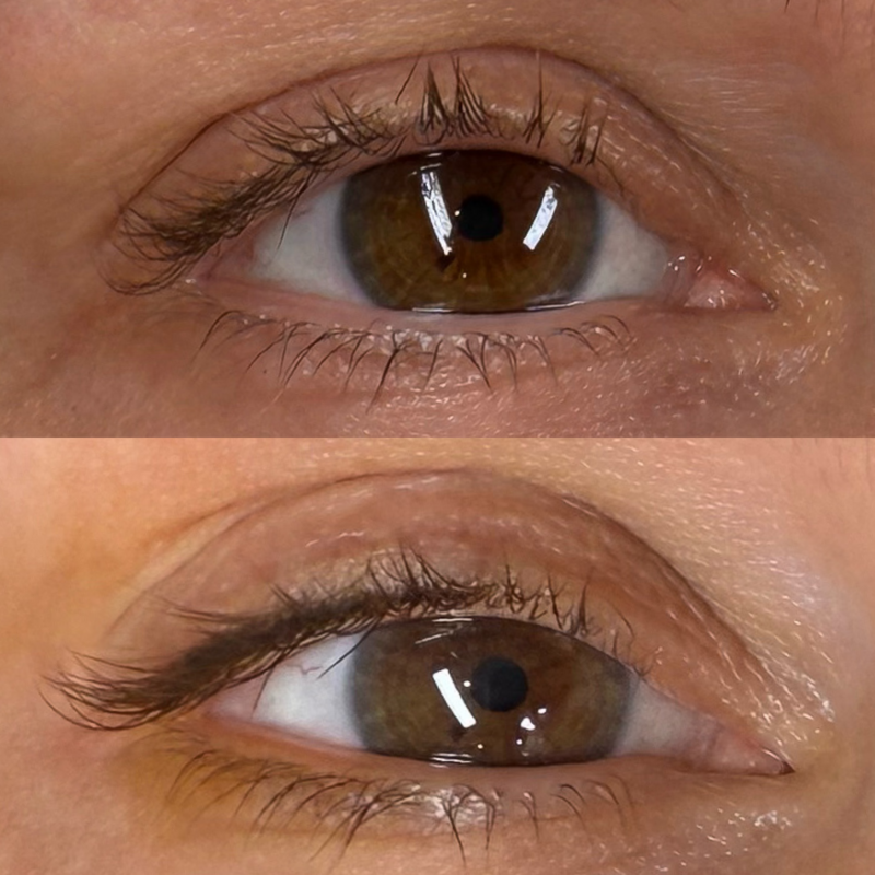 Lash Enhancement Before and After