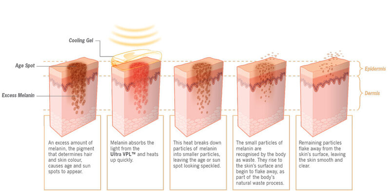 Massage facial Kobido