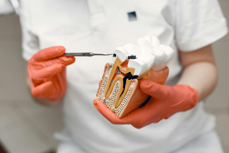 A tooth model of root canal therapy in Middleton, ID.