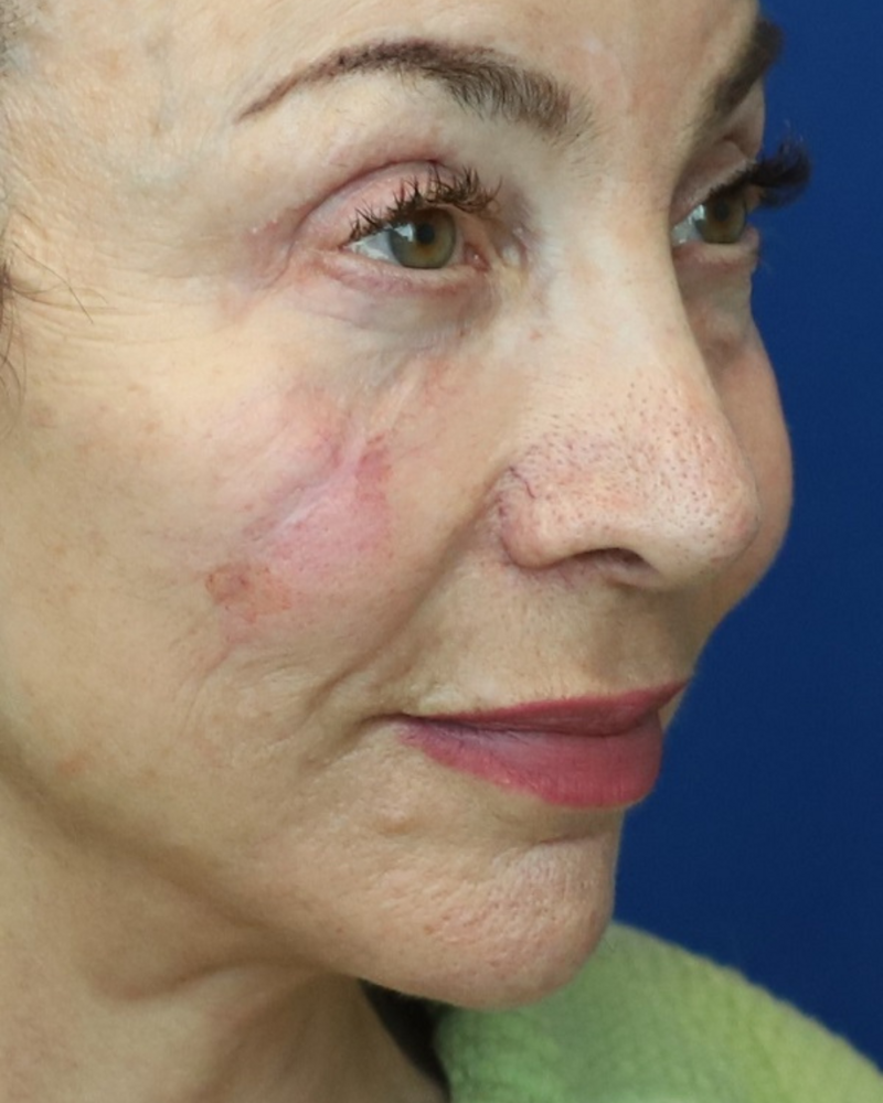 MedSpa Staff Looking At Camera