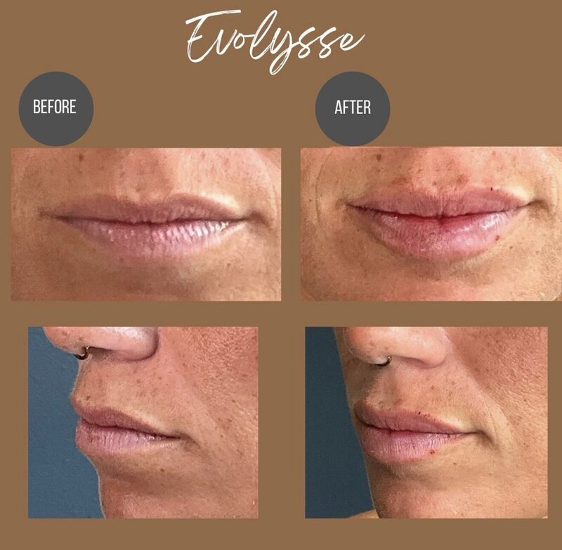 Medical Spa Brookfield, WI | Aesthetics & Weight Loss Medical Spa Brookfield, WI | Aesthetics & Weight Loss