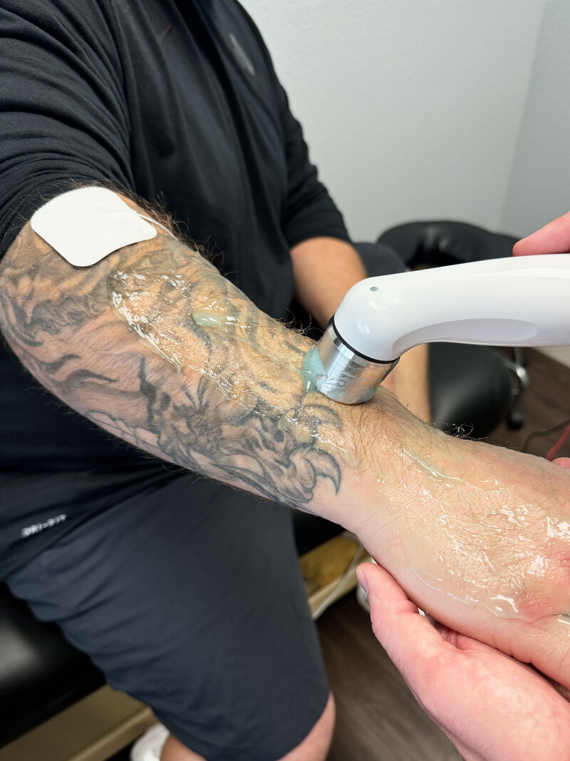 TENS and Interferential Therapy is an electrode therapy