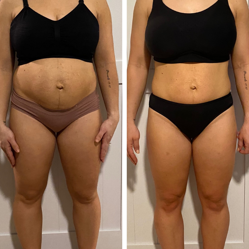 Before and after template_3FORMA Results-01