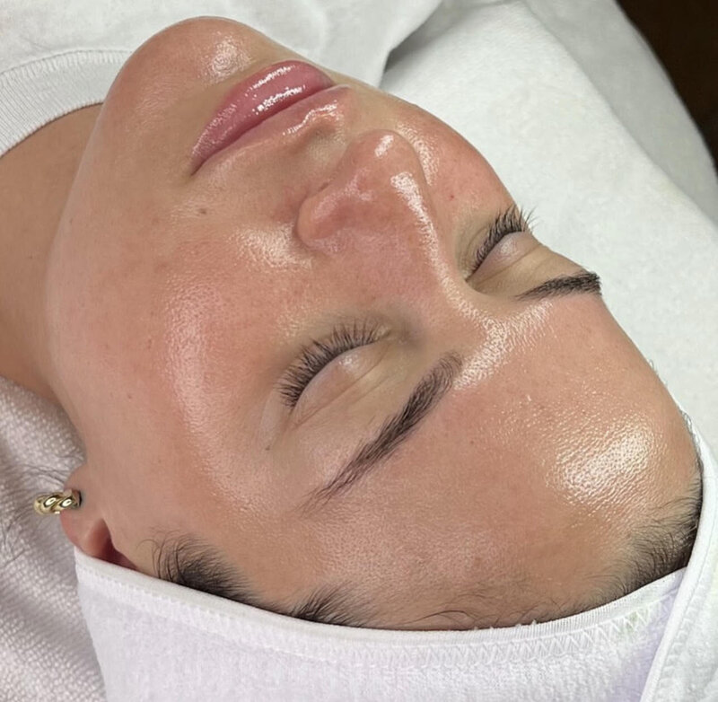 Aqua Facial