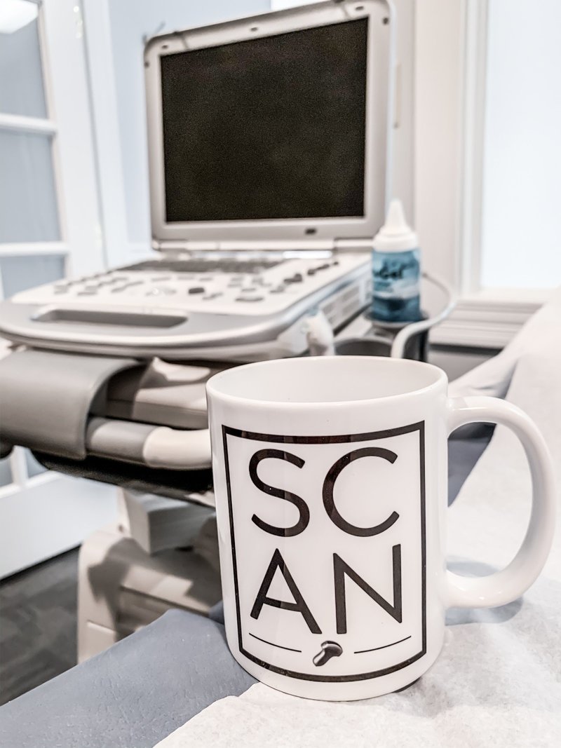 ultrasound machine on a stand next to an exam table with a coffee cup on it