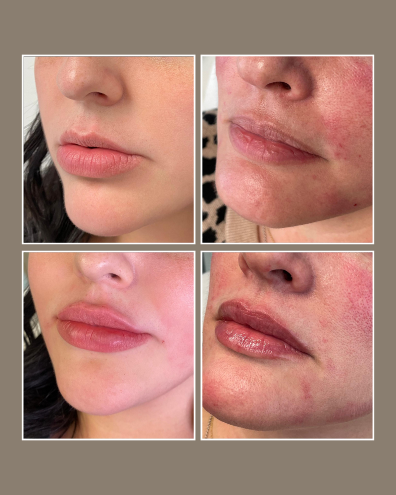 Skin Concerns - Glösense Dermatology and Aesthetics, Miami