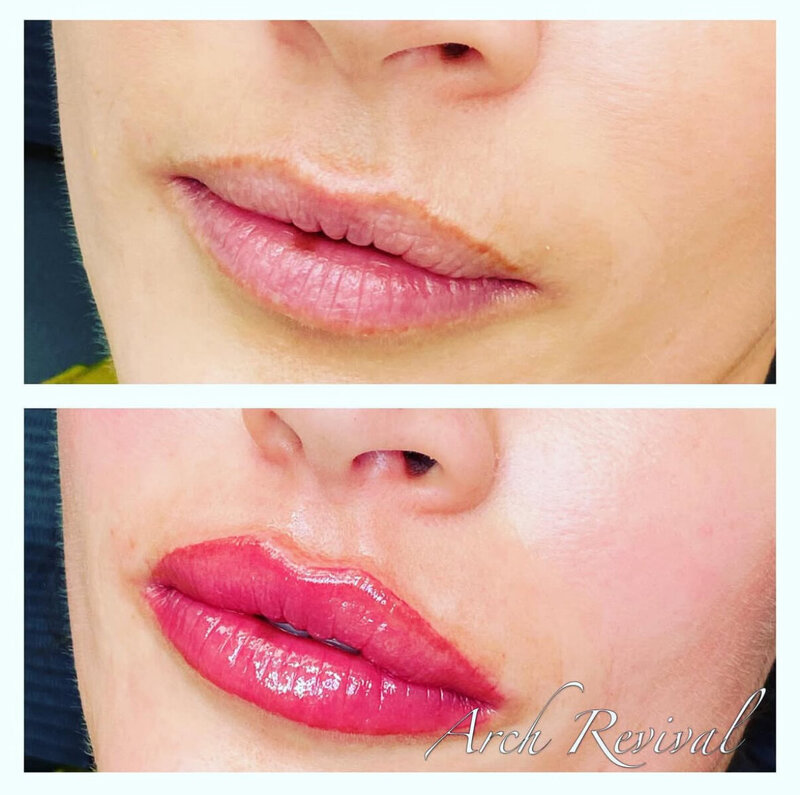Lip blush tattoo before & after - Arch Revival Fort Frances
