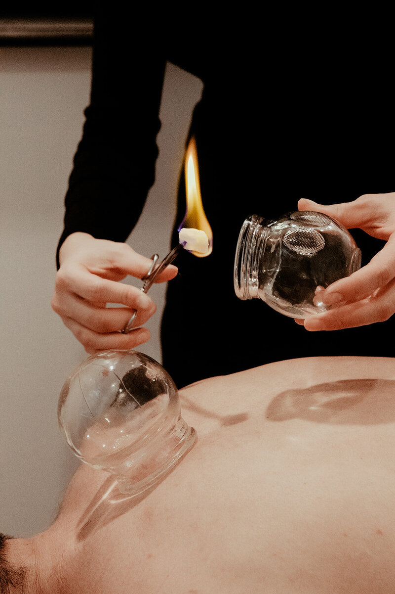 Acupuncturist dressed in black holds a glass cup in one hand and fire in another to administer fire-cupping on male patient's back