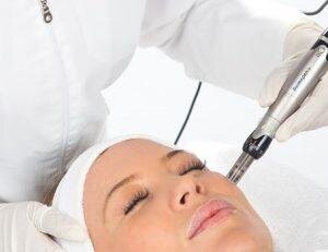 Microneedling Ultra Skin Clinic huidtherapie