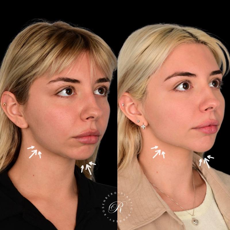 Copy of Copy of Template for Rosenberg Plastic Surgery B - 21