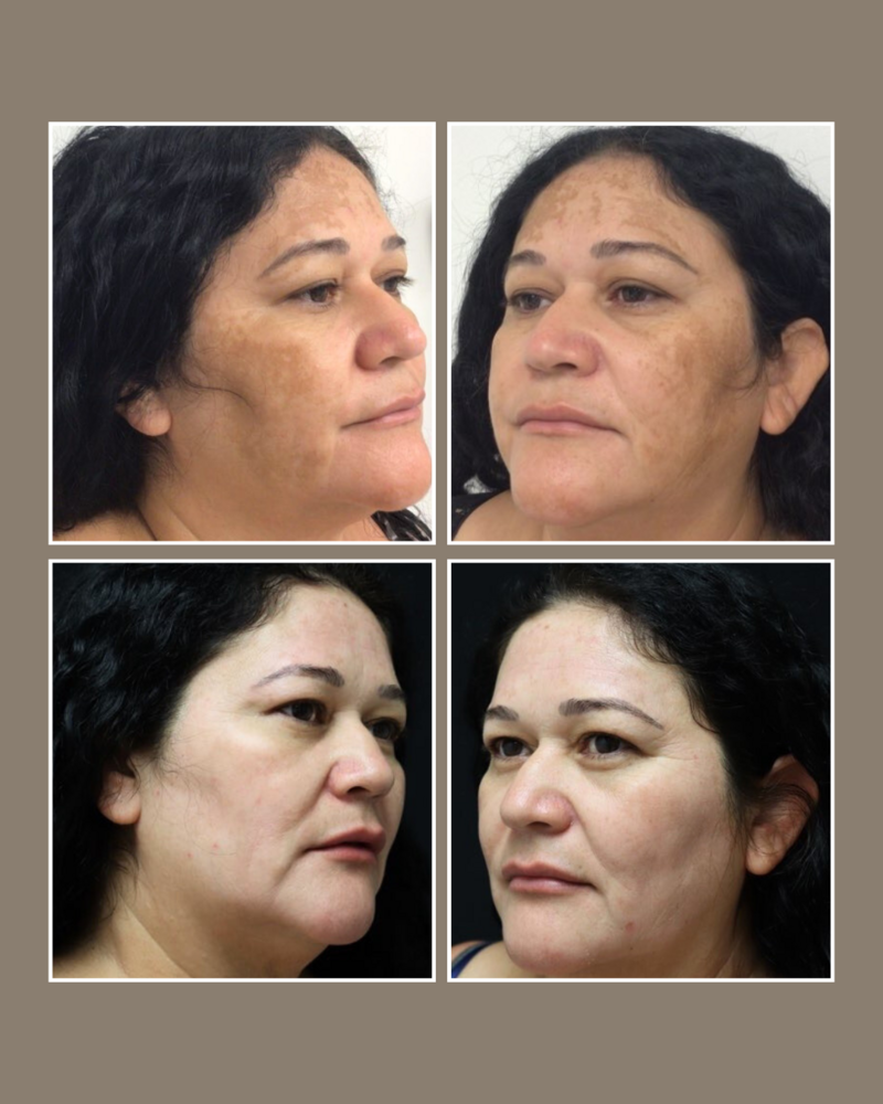 Skin Concerns - Glösense Dermatology and Aesthetics, Miami