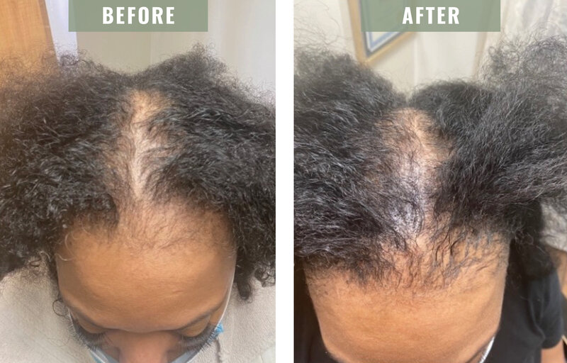BeforeandAfter_4