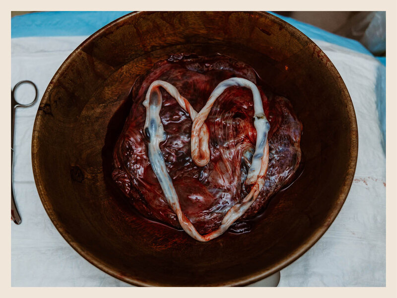 Birth is profound and transformative time in your life. The placenta is a symbol of this experience and honours the precious time that baby spent in the womb, we  love to photograph the placenta to capture this awesome part of life.