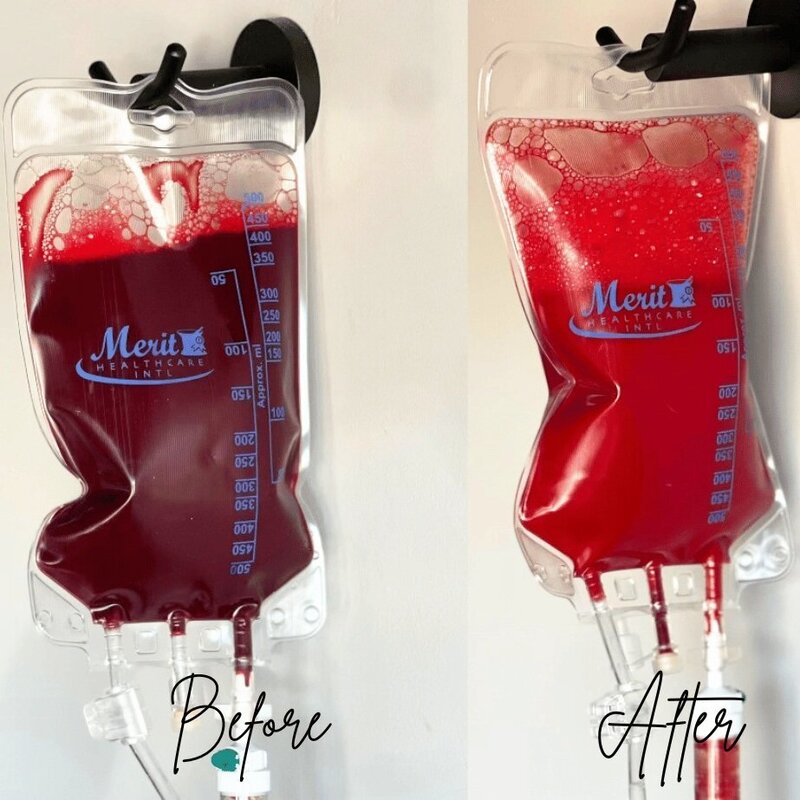 Before and after image of bag filled with dark red blood and bright red blood