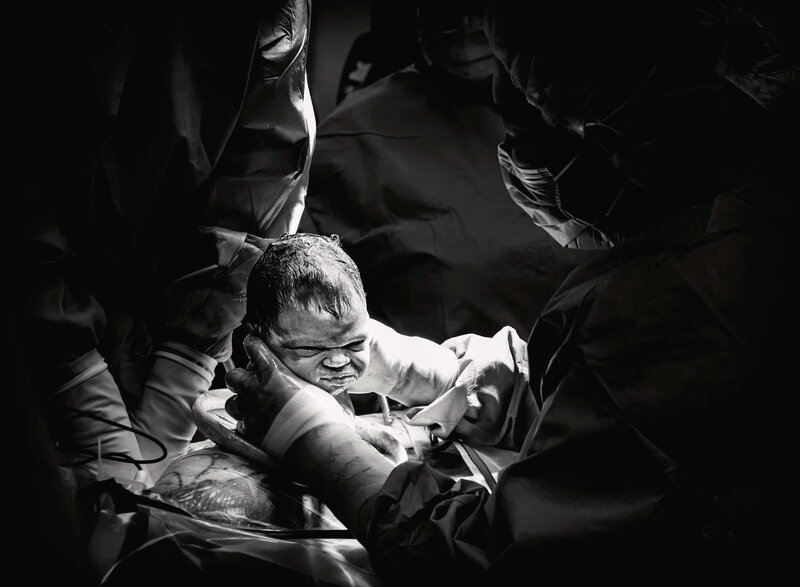cesarean-birth-las-vegas