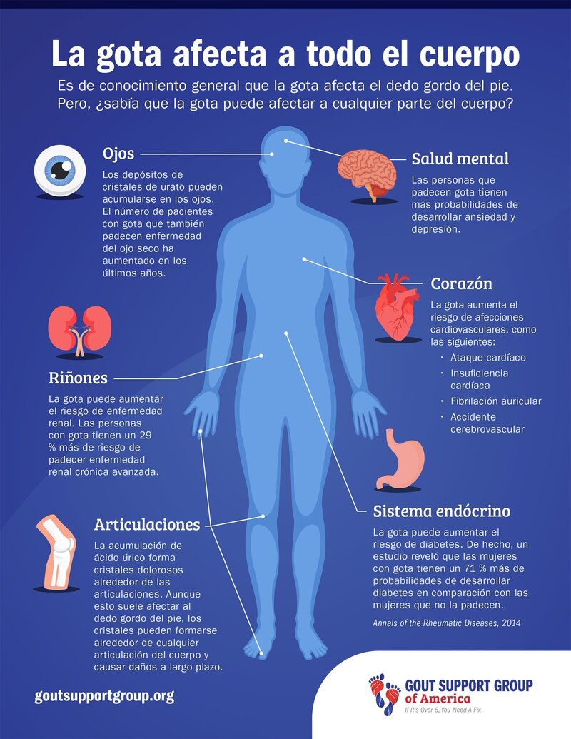 Gout Affects the Whole Body Infographic by Gout Support Group of America