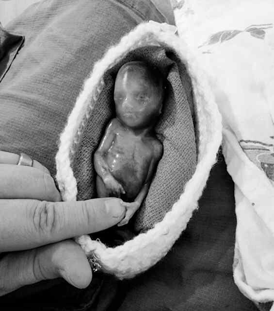 precious stillborn baby in bereavement cradle 
