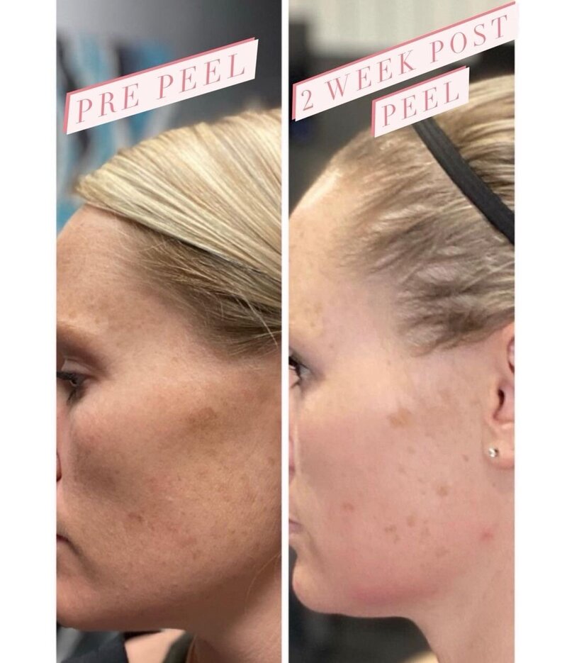 Client Results for services from Rich Medical Aesthetics in Midland, TX.