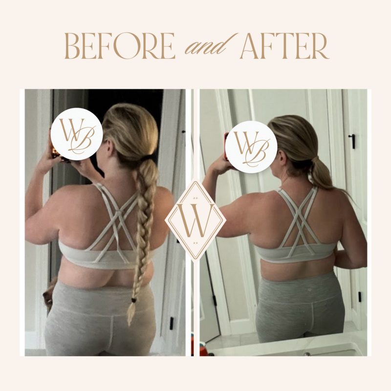 weight loss tirzepatide semaglutide