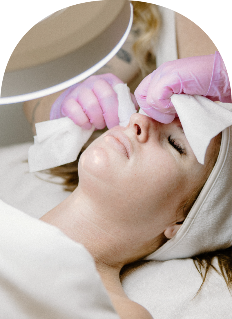 Newport Beach's best facials & chemical peels