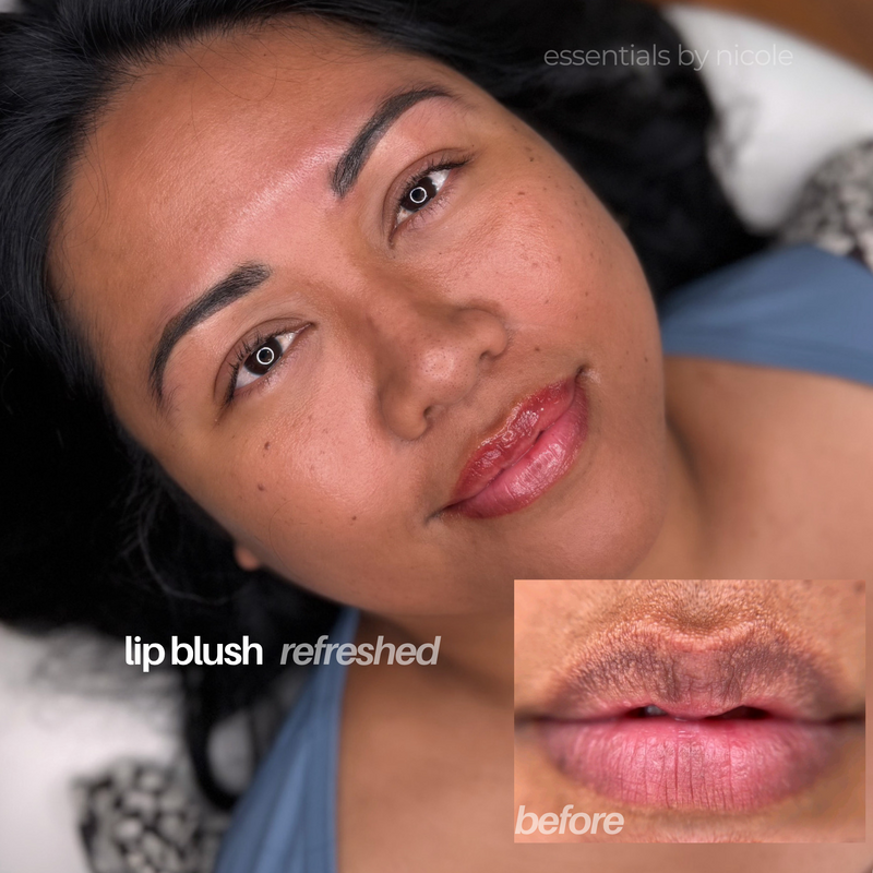 Before and after dark lip correction with color-neutralizing lip blush