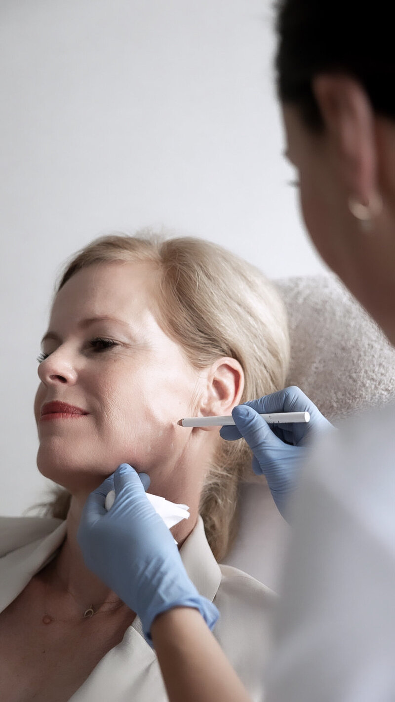 Filler behandeling Lizenka Adriaanse