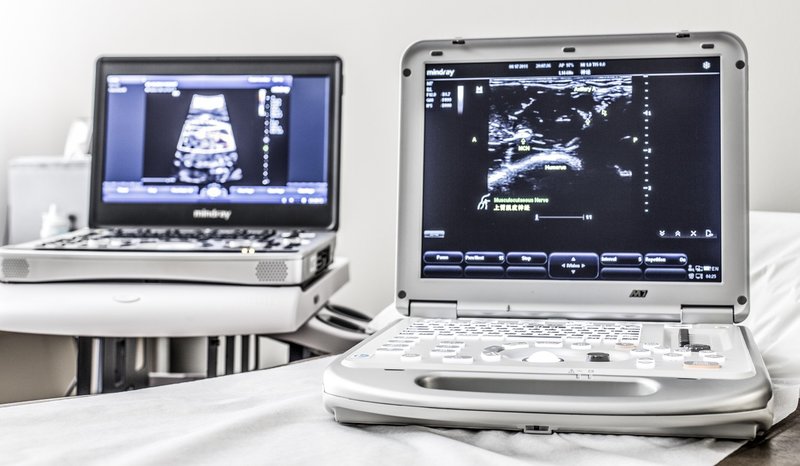 Ultrasound equipment open with images on them 