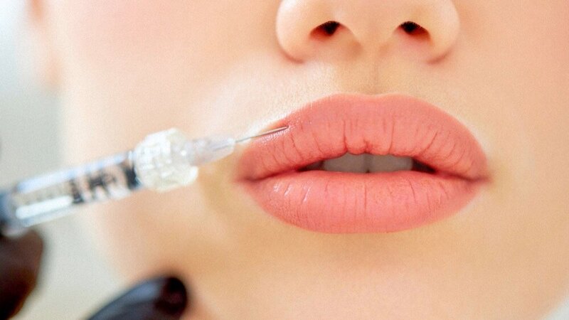 Lip filler being injected into top lip