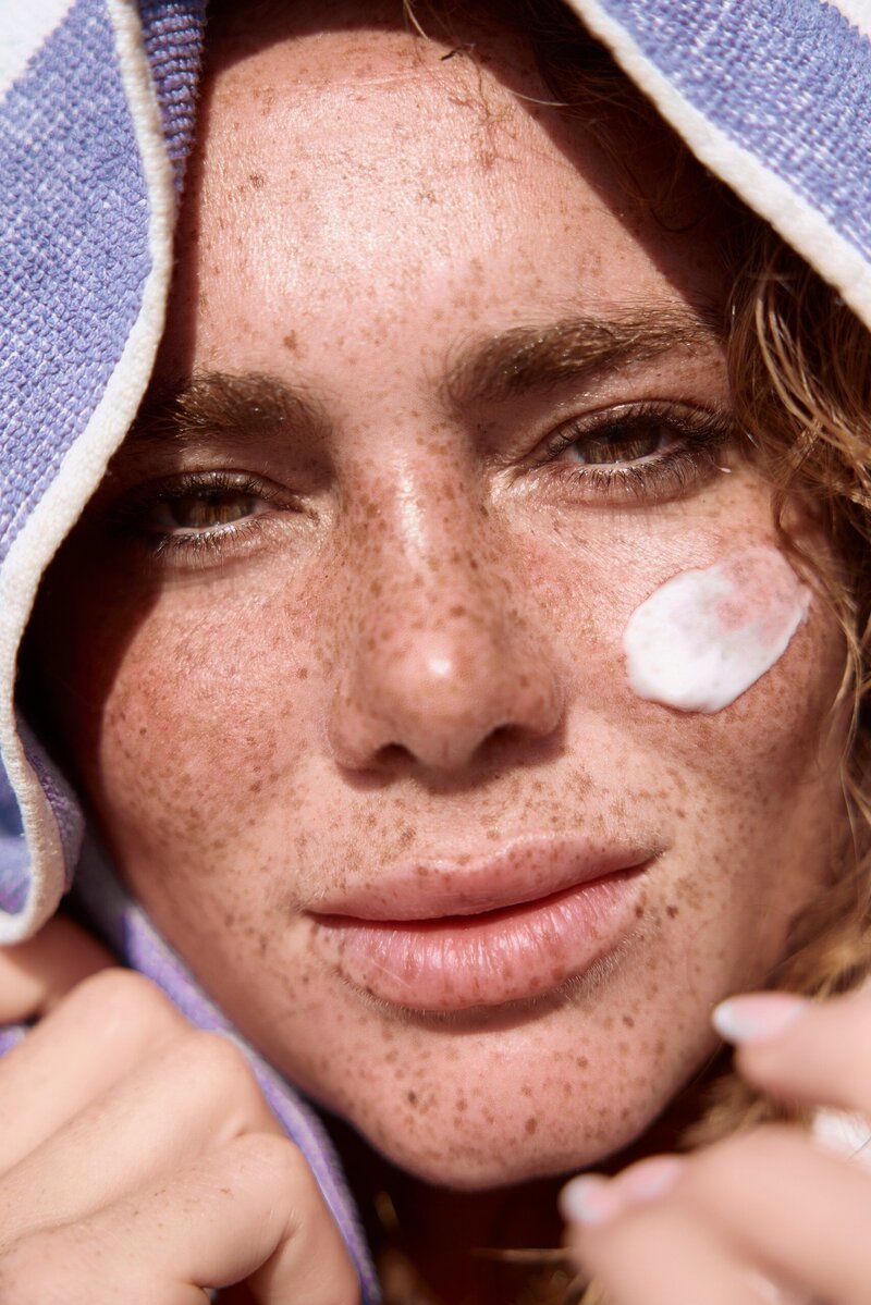 beauty close up of model with freckles and cream on her cheek
