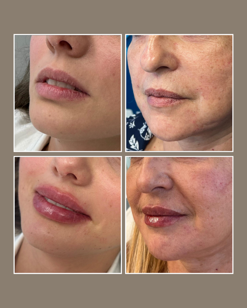 Skin Concerns - Glösense Dermatology and Aesthetics, Miami