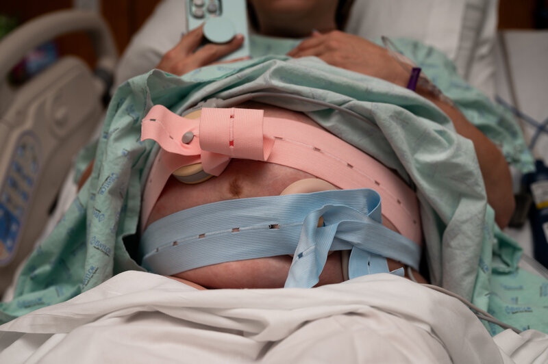 close up of mother's belly while she is preparing to give birth.