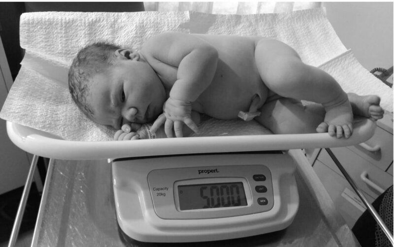 Erin Bowe 5kg baby birth trauma shoulder dystocia