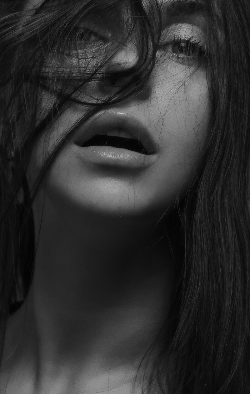 A close up photo of a woman smiling after smile lines.