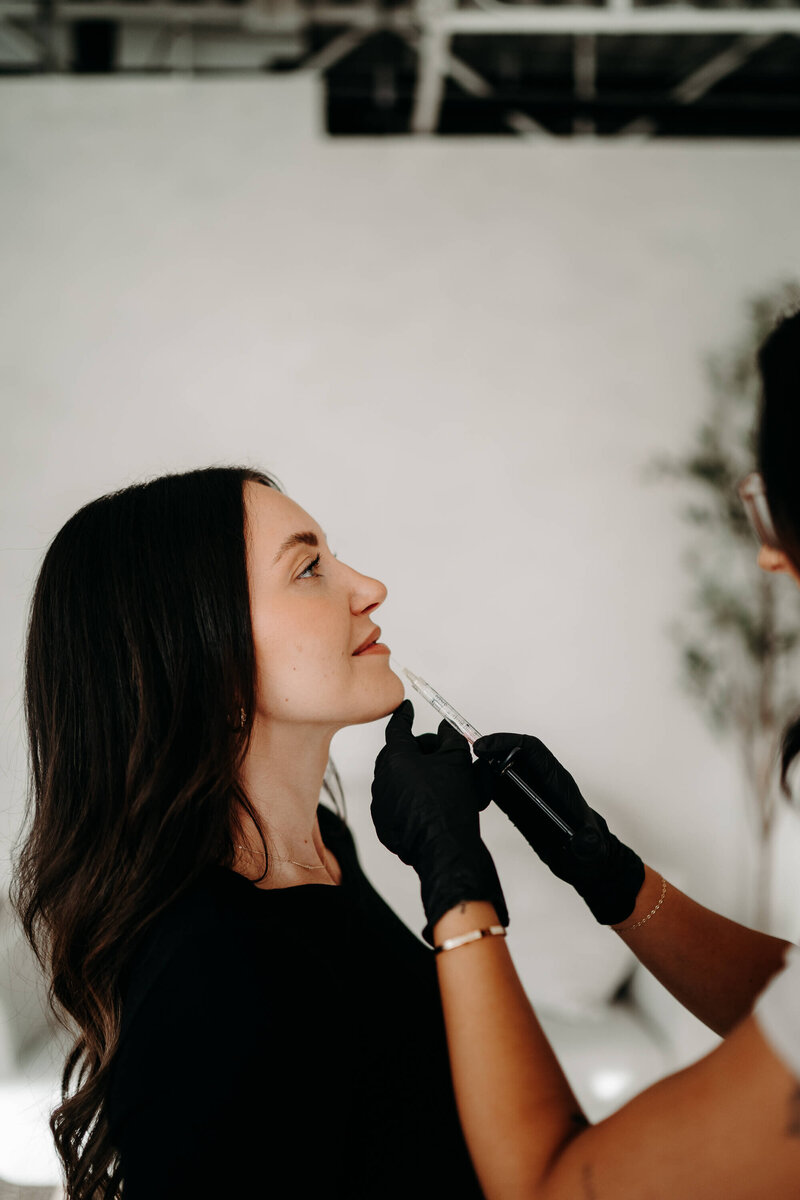 Dermal Fillers Edmonton
