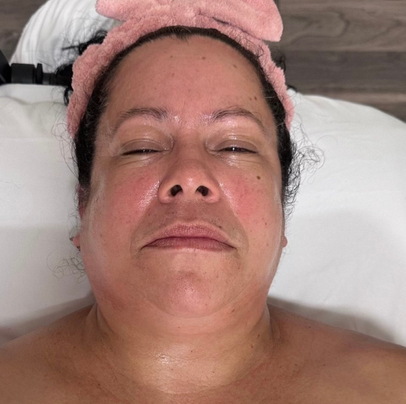 A women after she had a face lymphatic drainage massage