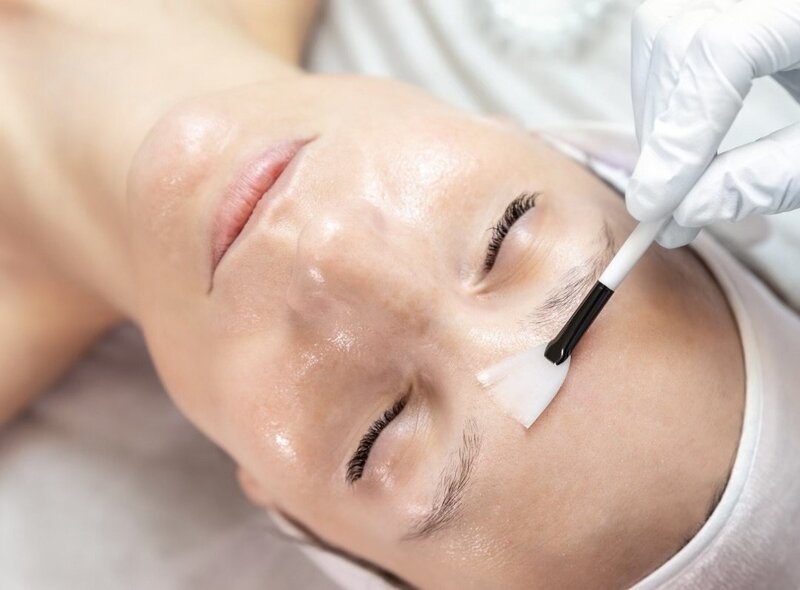 Woman having stimulator peel brushed onto her forehead