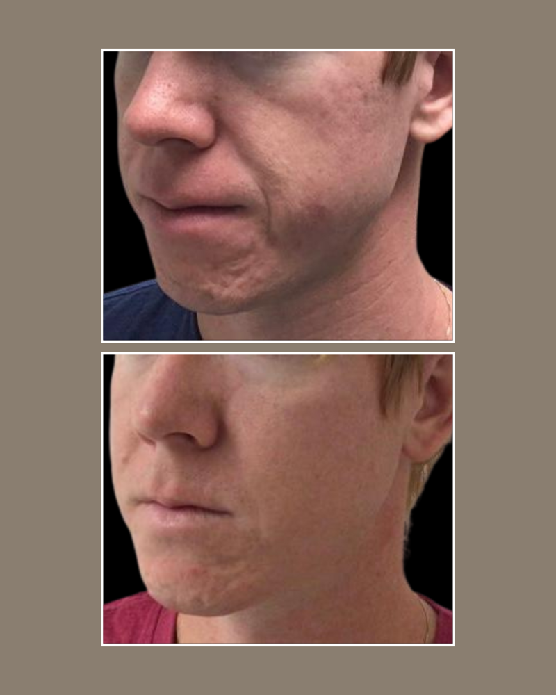 Skin Concerns - Glösense Dermatology and Aesthetics, Miami