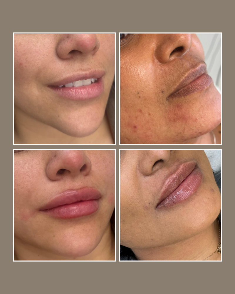 Skin Concerns - Glösense Dermatology and Aesthetics, Miami