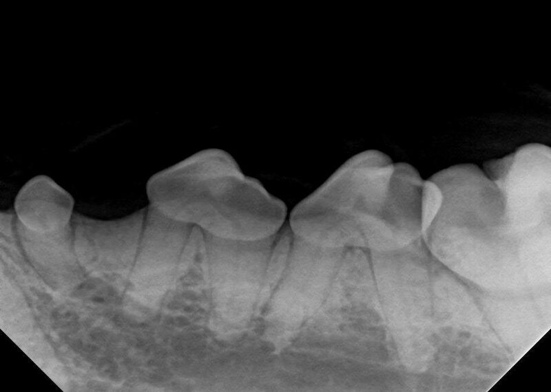 Dental xray2