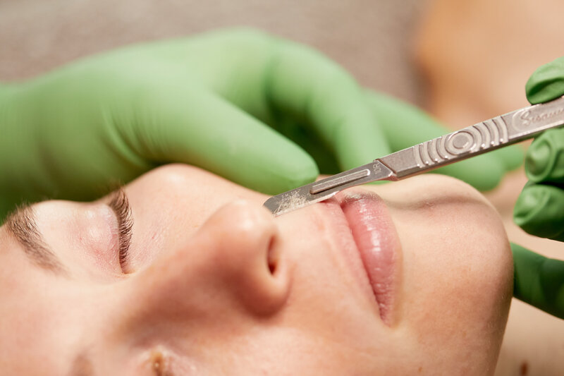 Berea, OH dermaplaning. Cleveland dermaplaning facial.