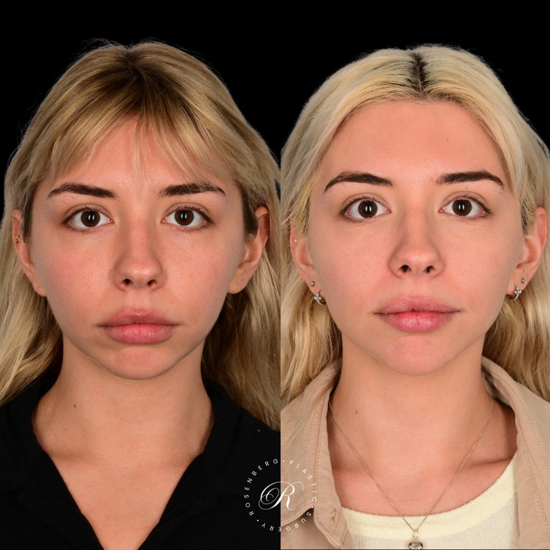 Copy of Copy of Template for Rosenberg Plastic Surgery B - 28